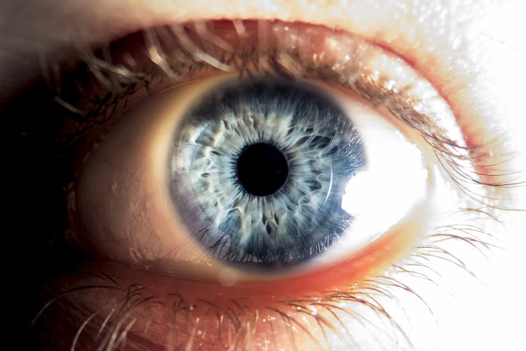 Curing blindness with stem cells – here’s the latest science Curing blindness with stem cells – here’s the latest science