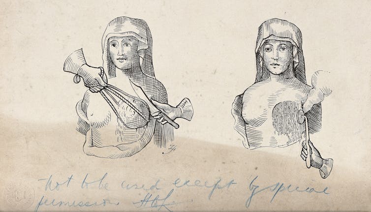 Mastectomies have been performed for over 500 years – yet we still can't talk about them 14 file 20200916 24 i9kyi4.jpg?ixlib=rb 1.1