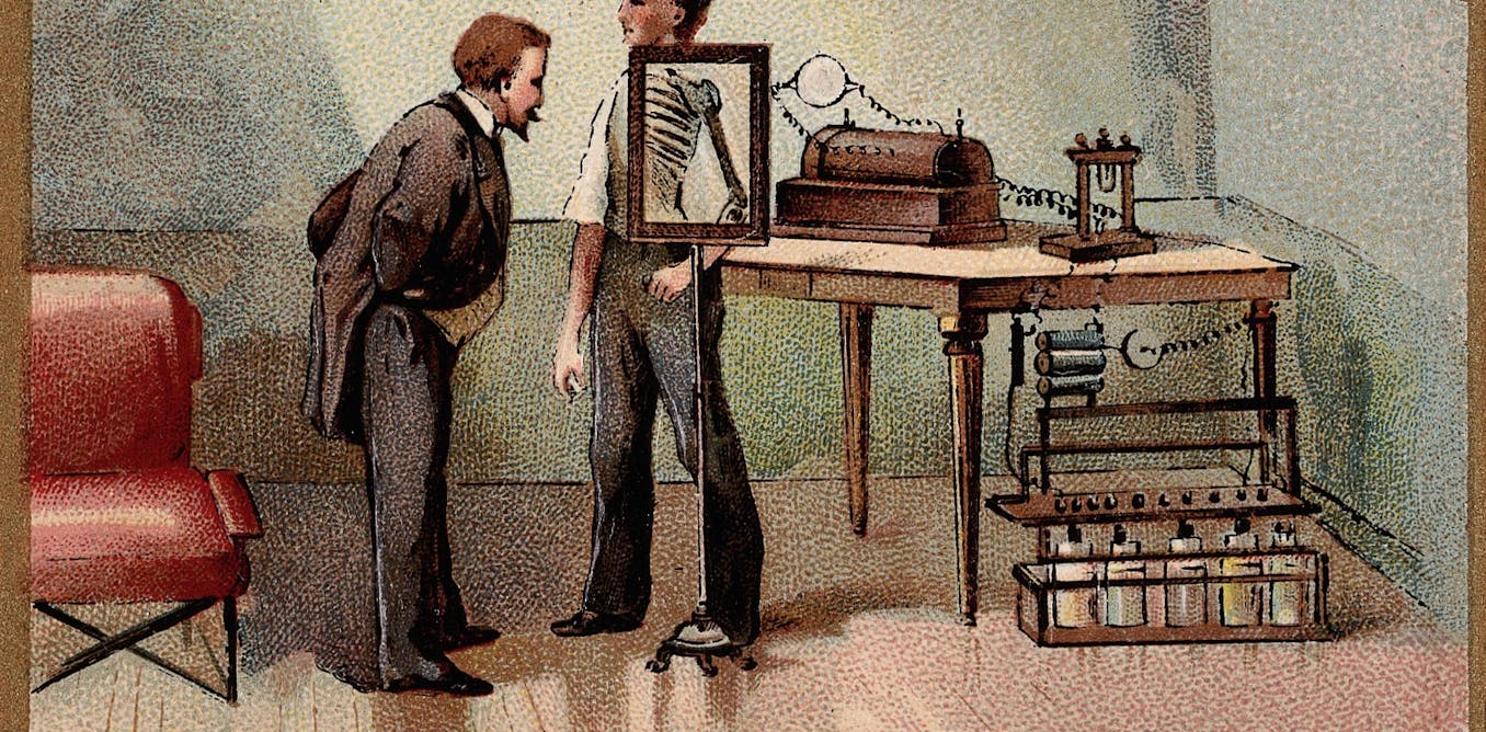 On The 1th Anniversary Of The X Ray A Look At How It Changed Our View Of The World