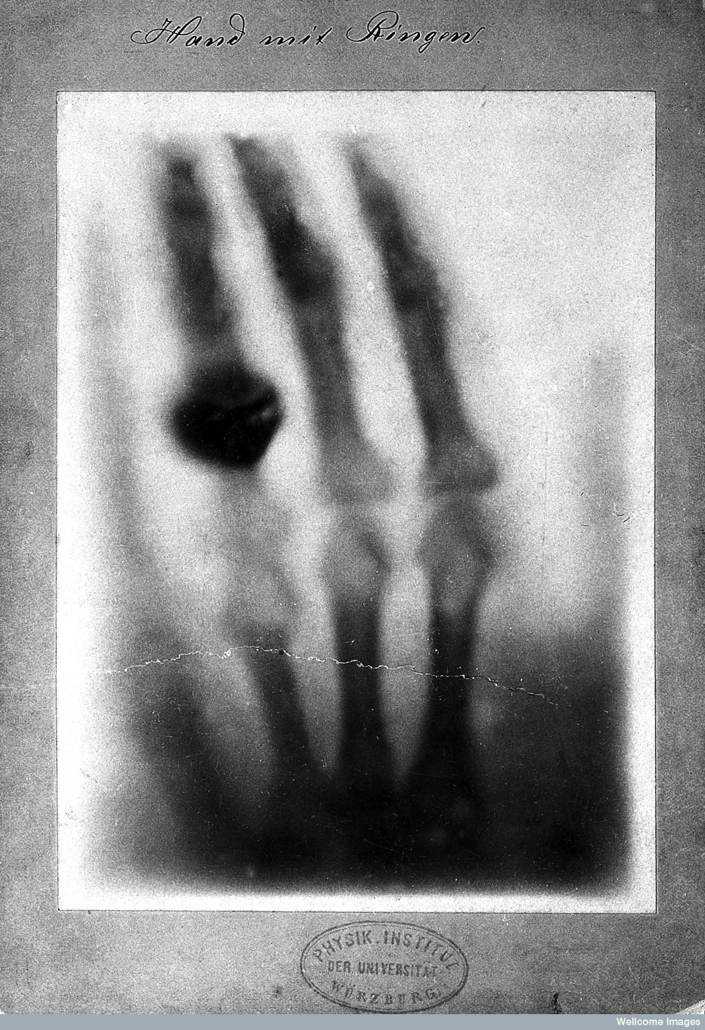 On the 120th anniversary of the X-ray, a look at how it changed our ...