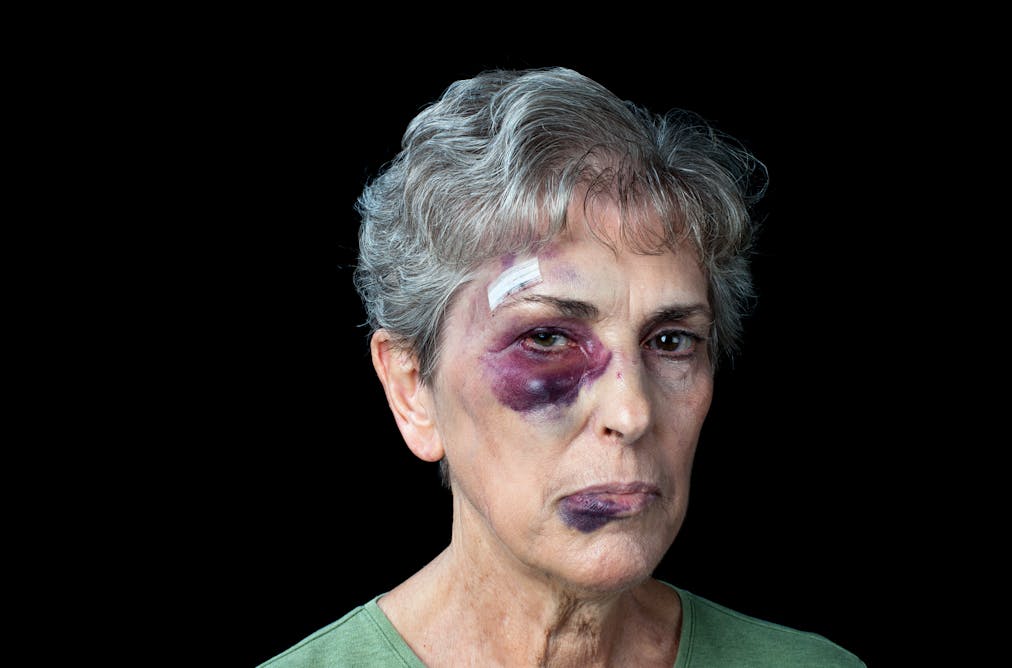elder abuse report ignores