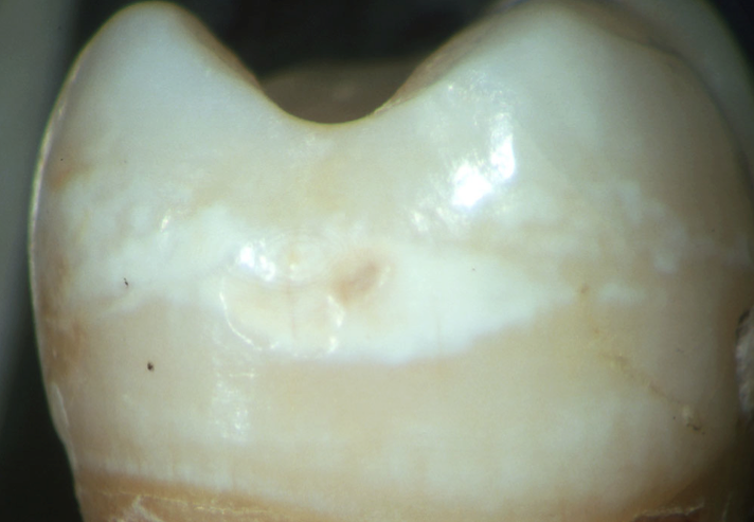 Health Check: is chewing gum actually good for your teeth?