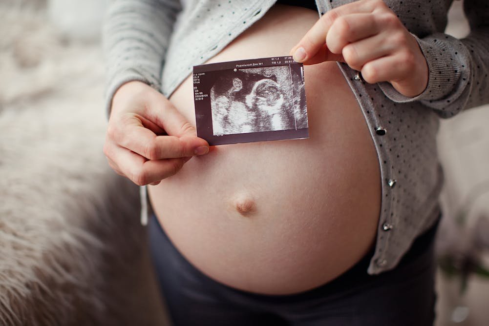 беременность и грудь форум фото 64