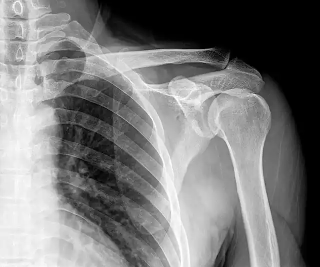 Lead Can Toxic lead can stay in the body for years after exposure