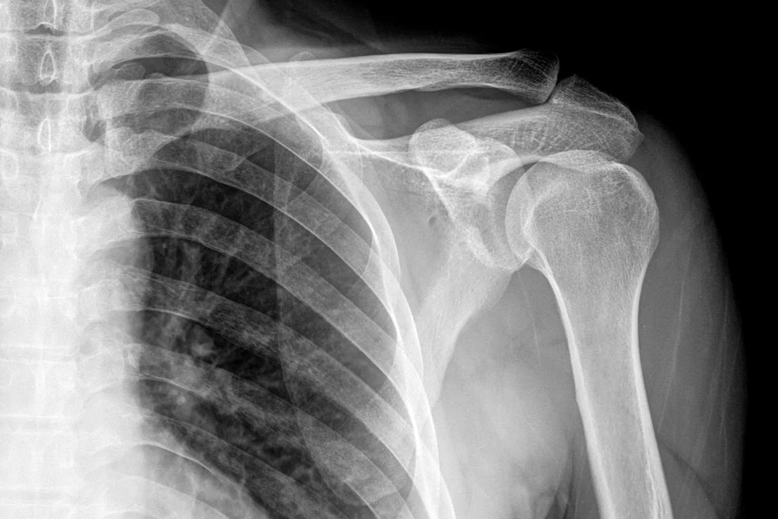 Strong Lead Body Toxic lead can stay in the body for years after exposure
