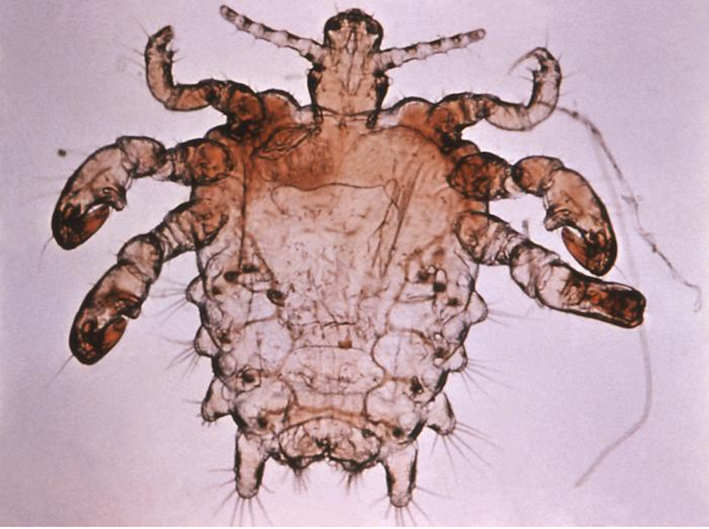 Magnified pubic lice