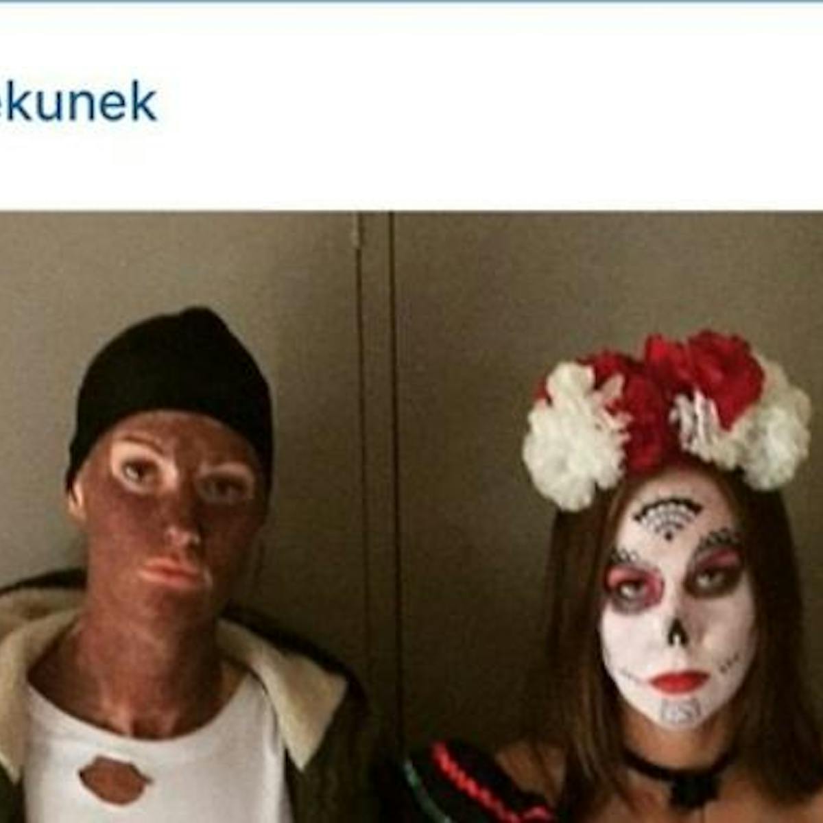 Blackface And Blaming Indigenous Health Woes On Culture Are Two