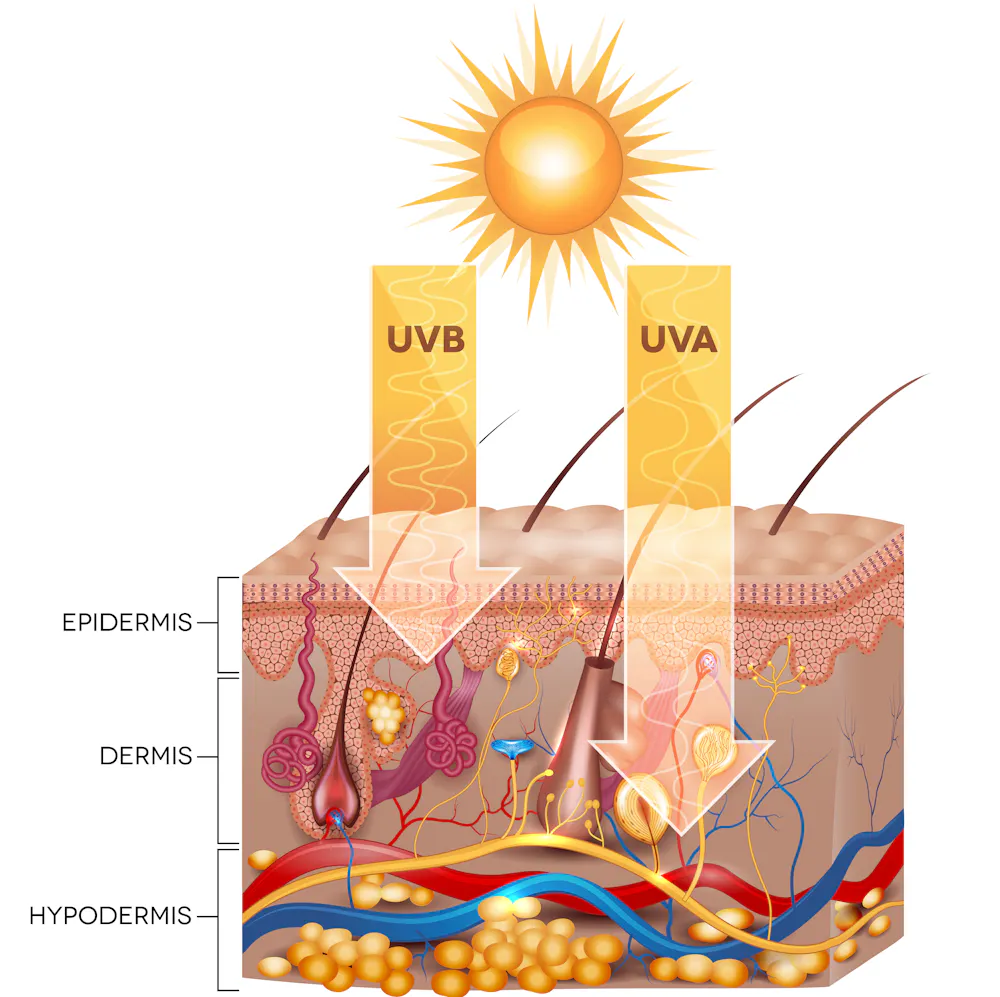 Explainer What Happens To Your Skin When You Get Sunburnt explainer-what-happens-to-your-skin-when-you-get-sunburnt