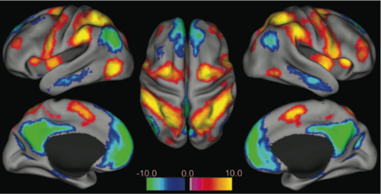 cerveau activité synchronisée état de conscience