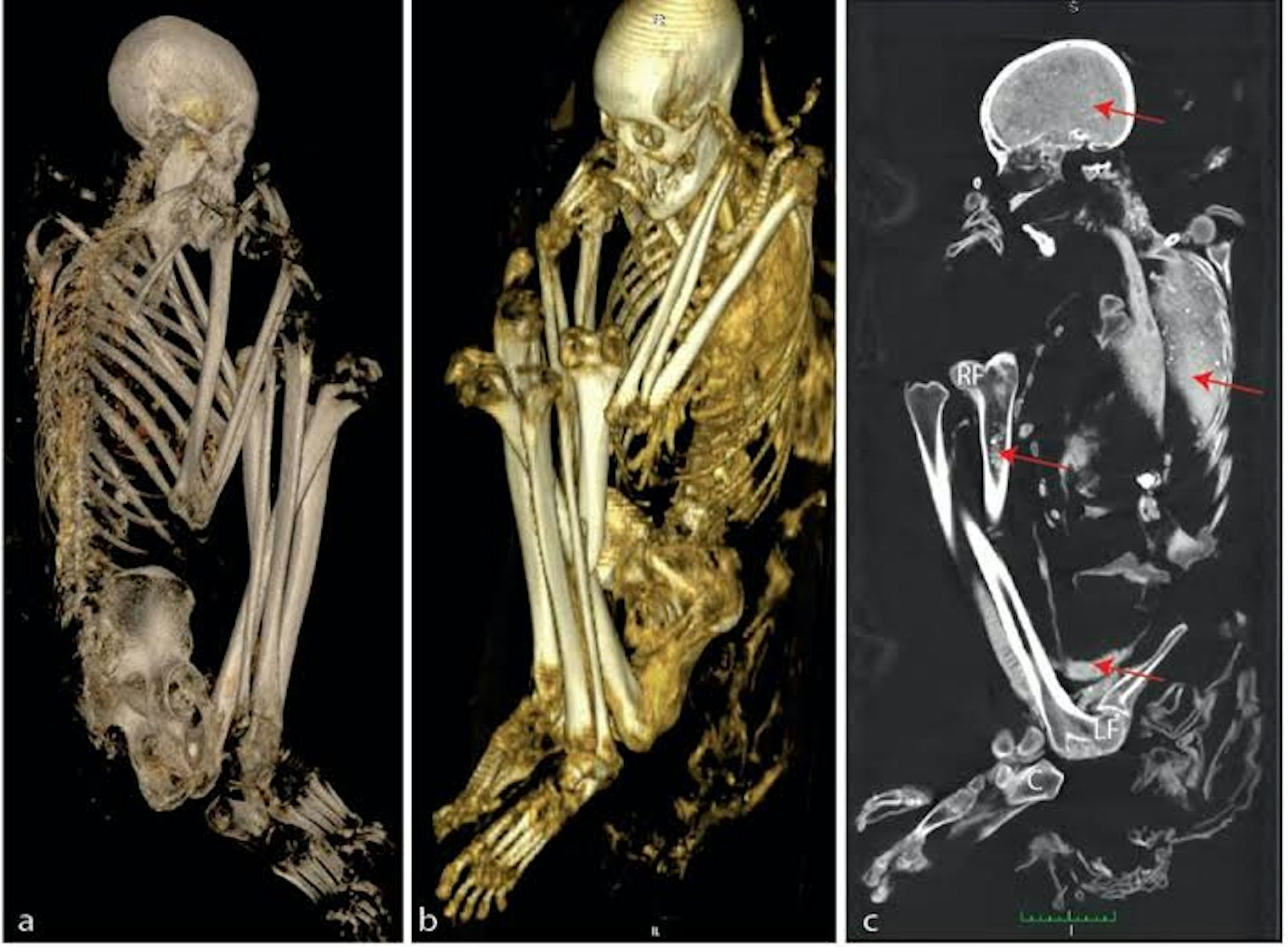 Scans and DNA tests reveal the secrets of a rare African mummy