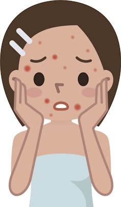 Health Check: is it bad to pop your pimples?