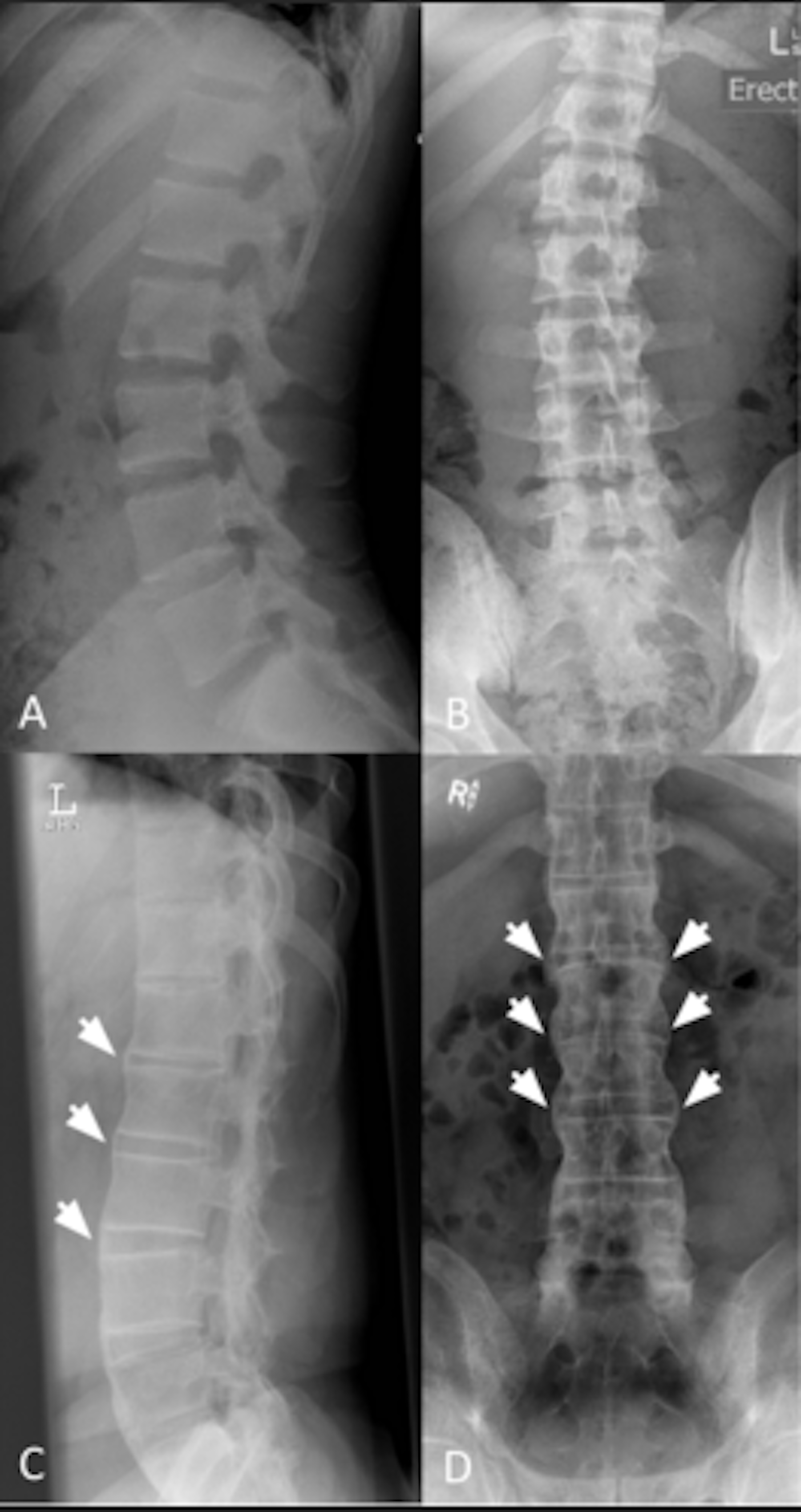 Unexplained Lower Stomach Vibrations: 7 Possible Reasons - 48tcgjy