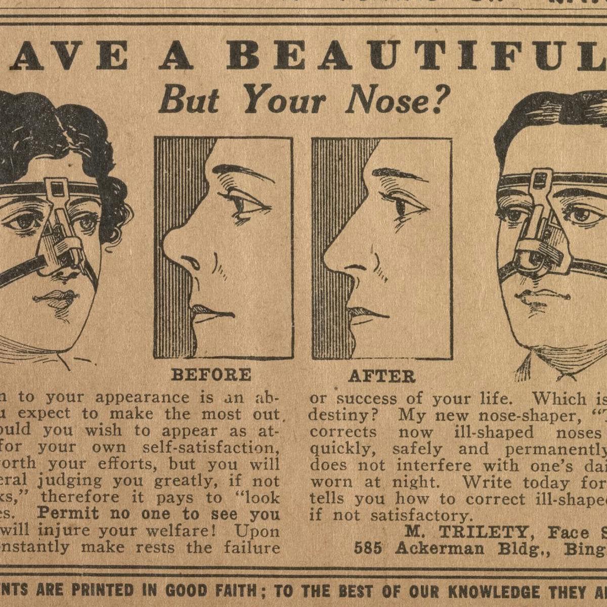 Friday Essay The Ugly History Of Cosmetic Surgery