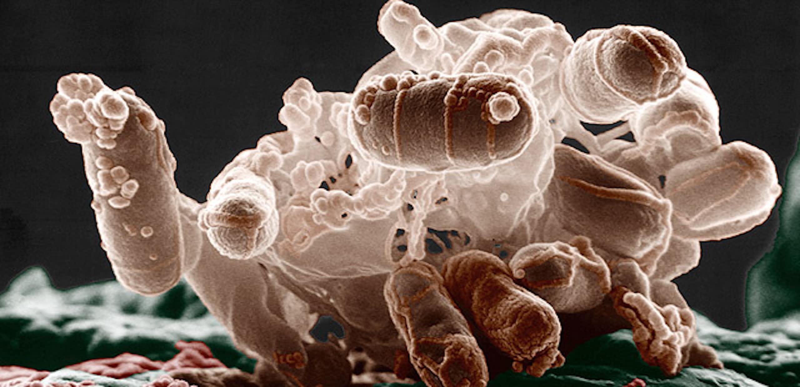 Virus, bactérie, parasite ? Connaissez vos microbes sur le bout des doigts !