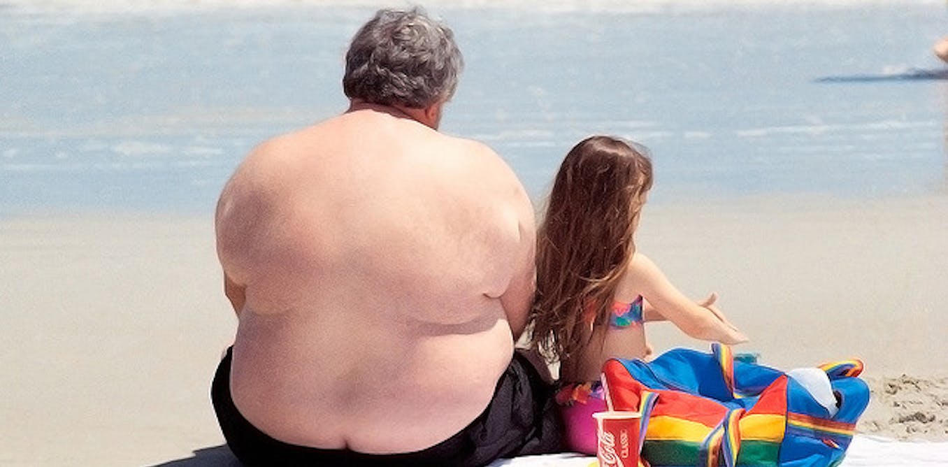 Много толстых мужиков. Жирные на пляже. Жирные люди на пляже.