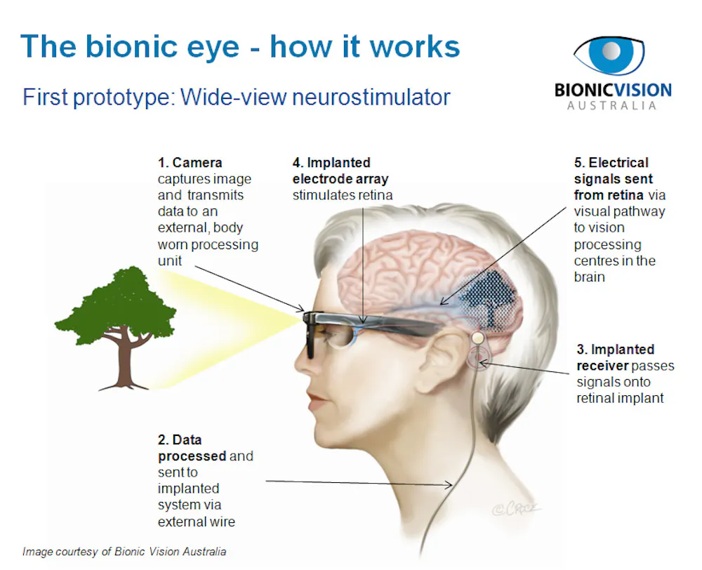 Bionic Eye Character Bionic vision: the fight for sight