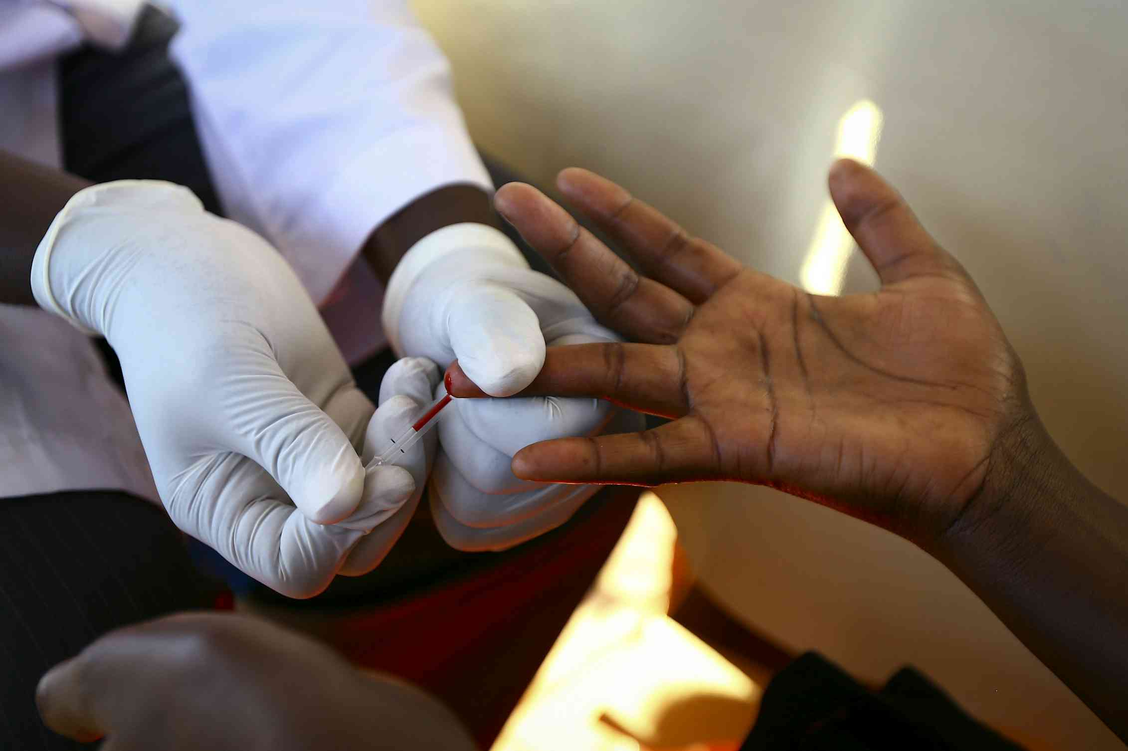 HIV ‘test and treat’ strategy can save lives – but it needs to be ...