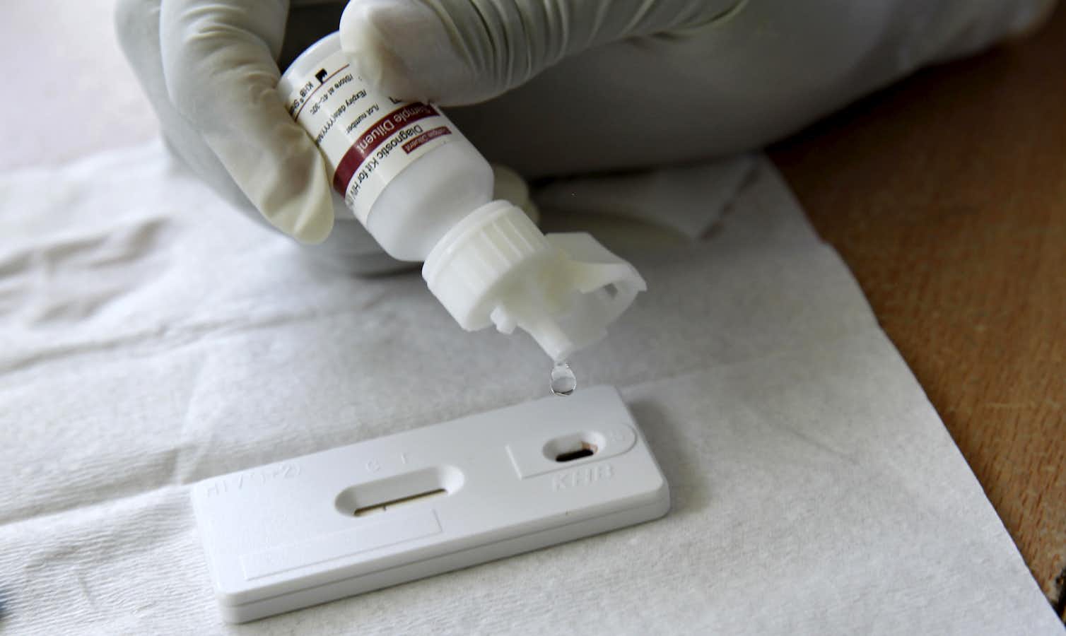 HIV 'test and treat' strategy can save lives but it needs to be easier for patients to start HIV 'test and treat' strategy can save lives but it needs to be easier for patients to start