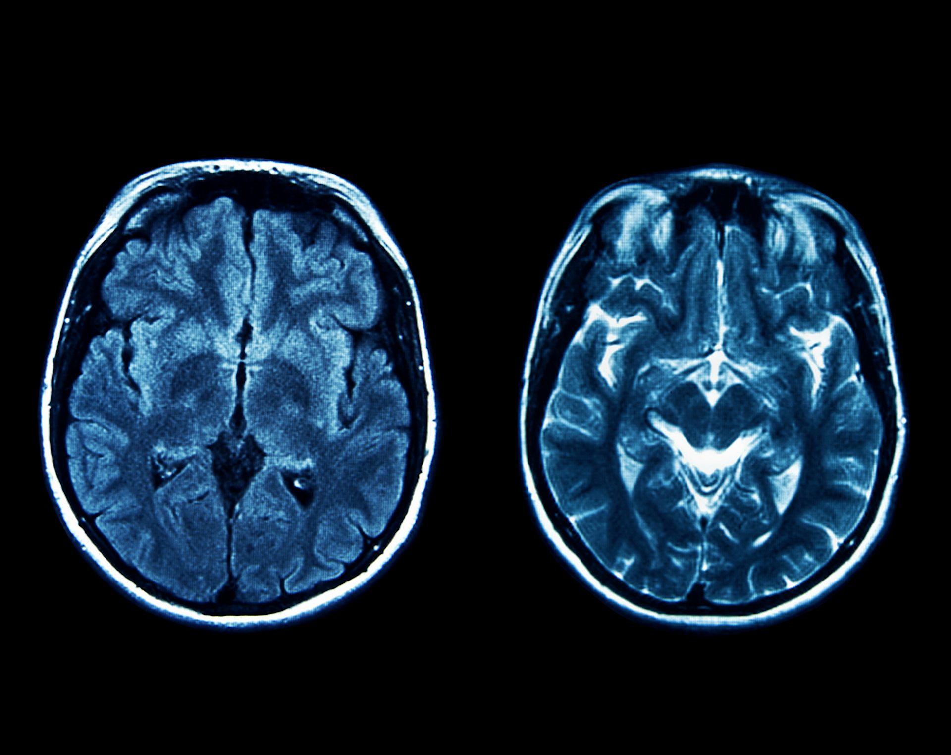 thebrain 11 crack