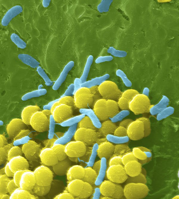 Три болезнетворные бактерии