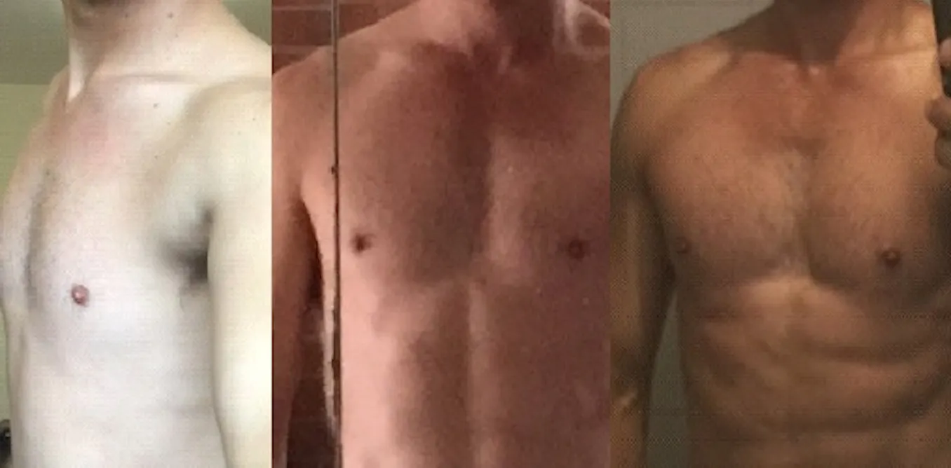 Is this injectable tanning drug safe to use? Is this injectable tanning drug safe to use?