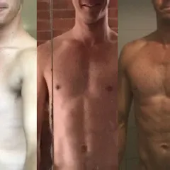 melanotan australia 2015 Five primary melanomas in situ in a patient with recent tanning bed use, exposure, and anabolic hormone use View of Association of tanning