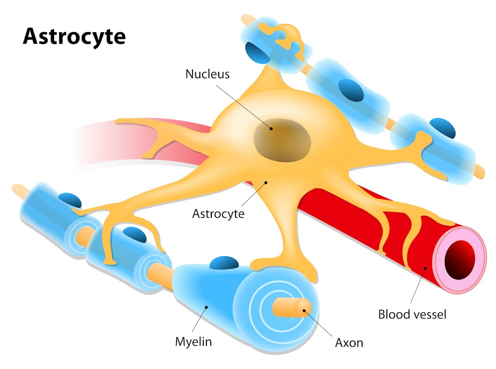 Glioblastoma why these brain cancers are so difficult to treat