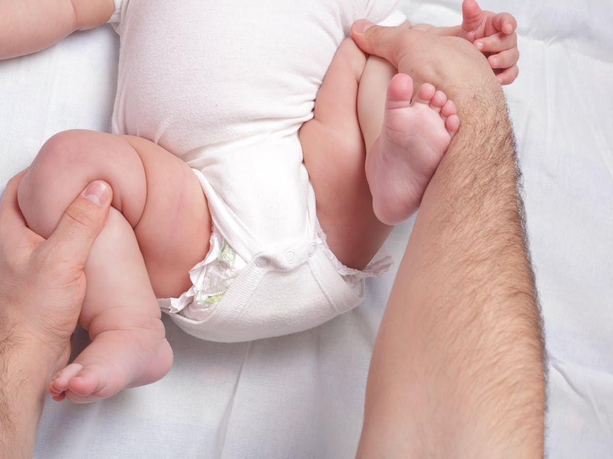Is Hip Dysplasia In My Newborn Something To Worry About Is Hip Dysplasia In My Newborn Something To Worry About