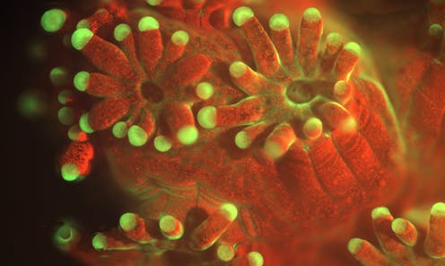 Underwater Microscope Provides New Views Of Ocean Floor Sea