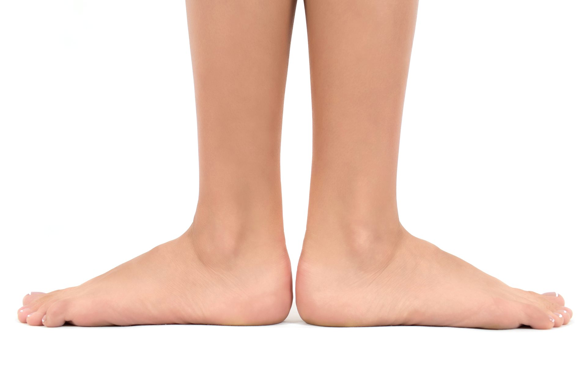 What are 'flat feet' in children and 