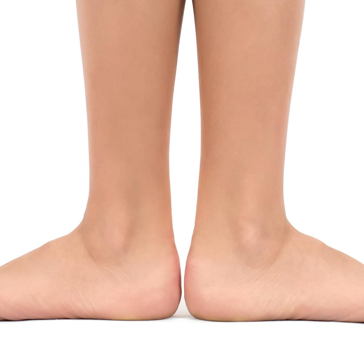 What Are Flat Feet In Children And Are They Something To Worry About What Are Flat Feet In Children And Are They Something To Worry About