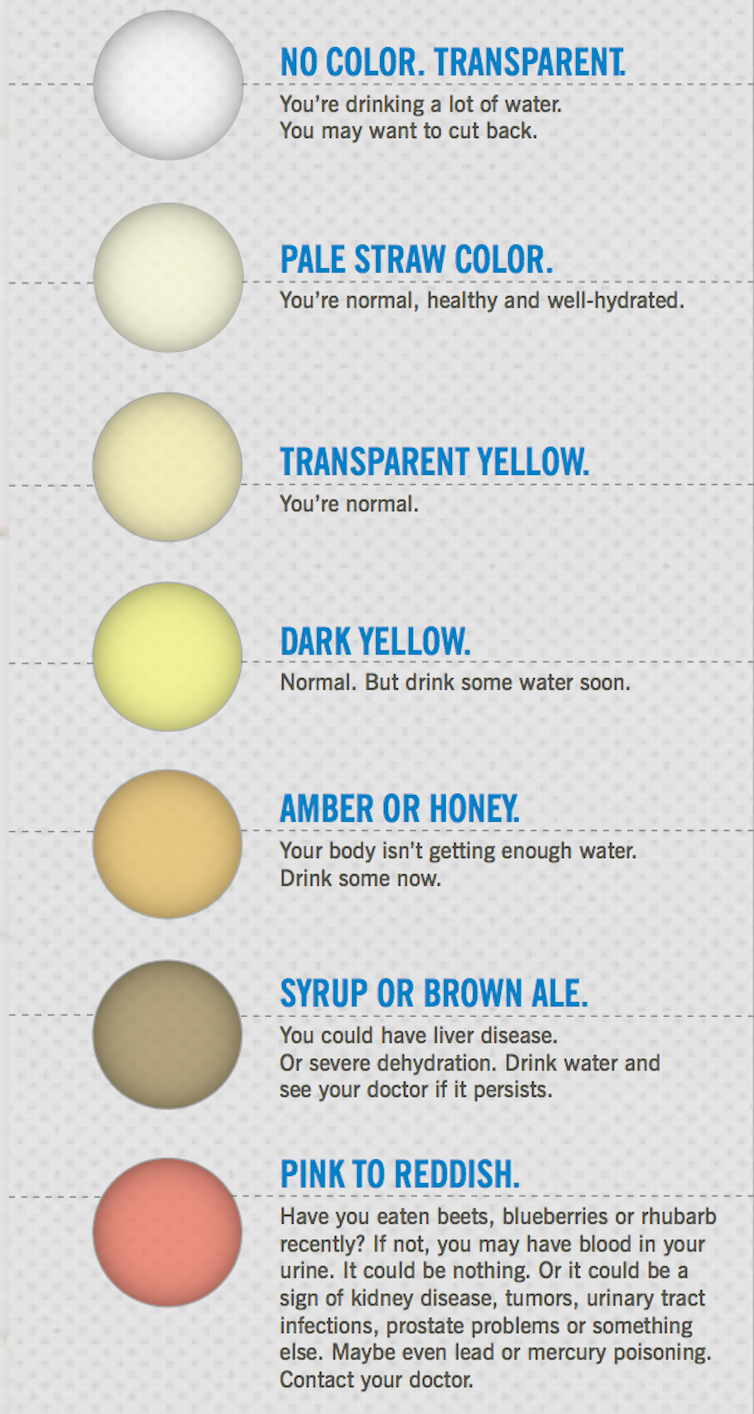 dark yellow urine symptoms