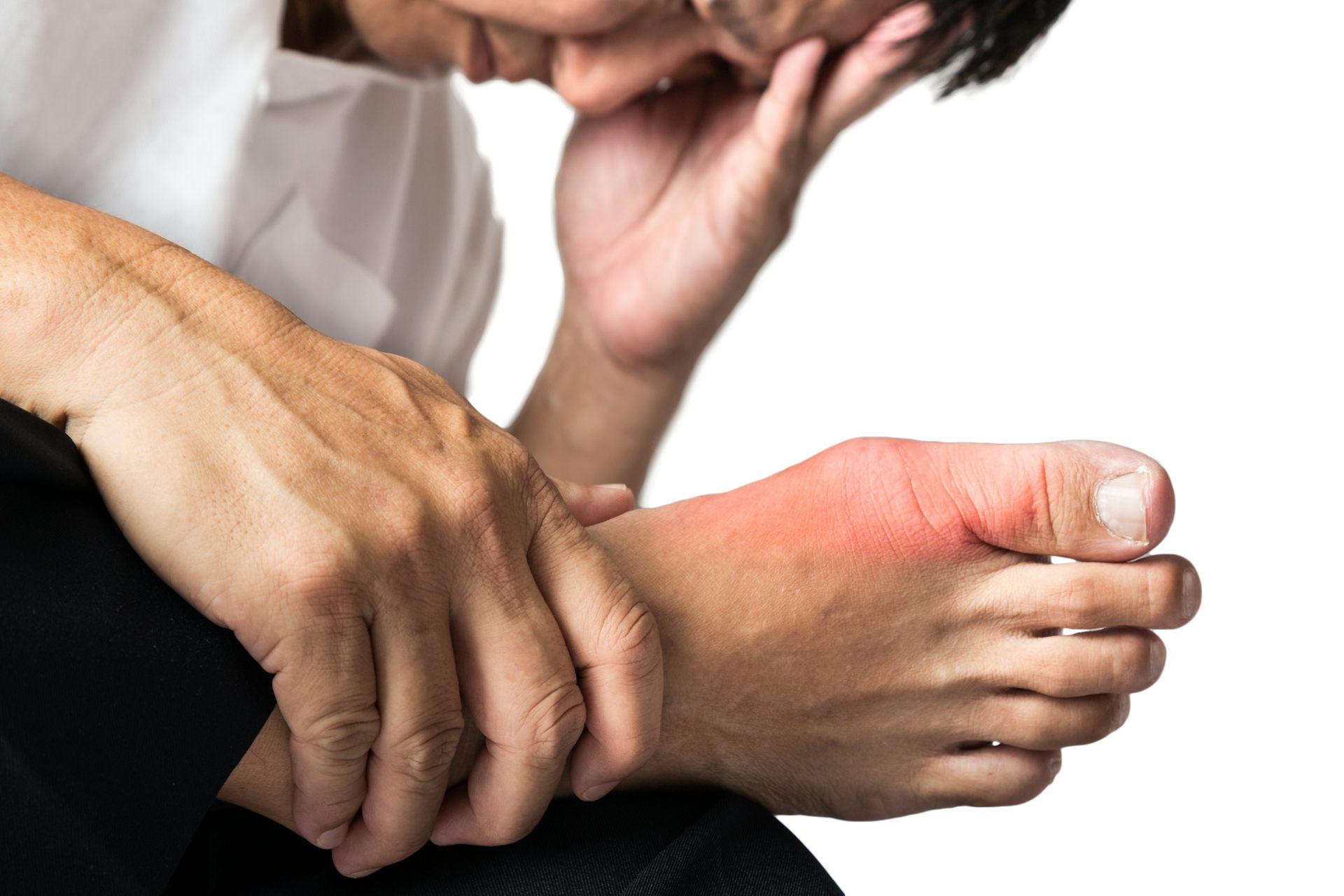 what causes gout flare ups
