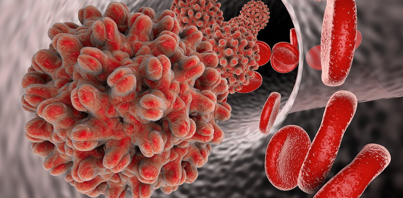 hiv and liver cancer viață largă a benzii