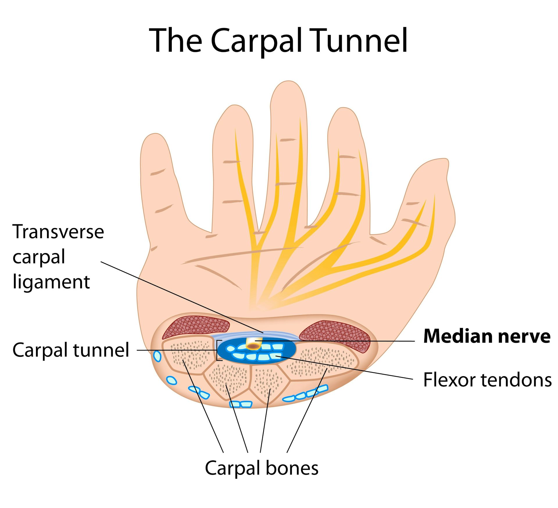 Explainer what is carpal tunnel syndrome and what happens if I