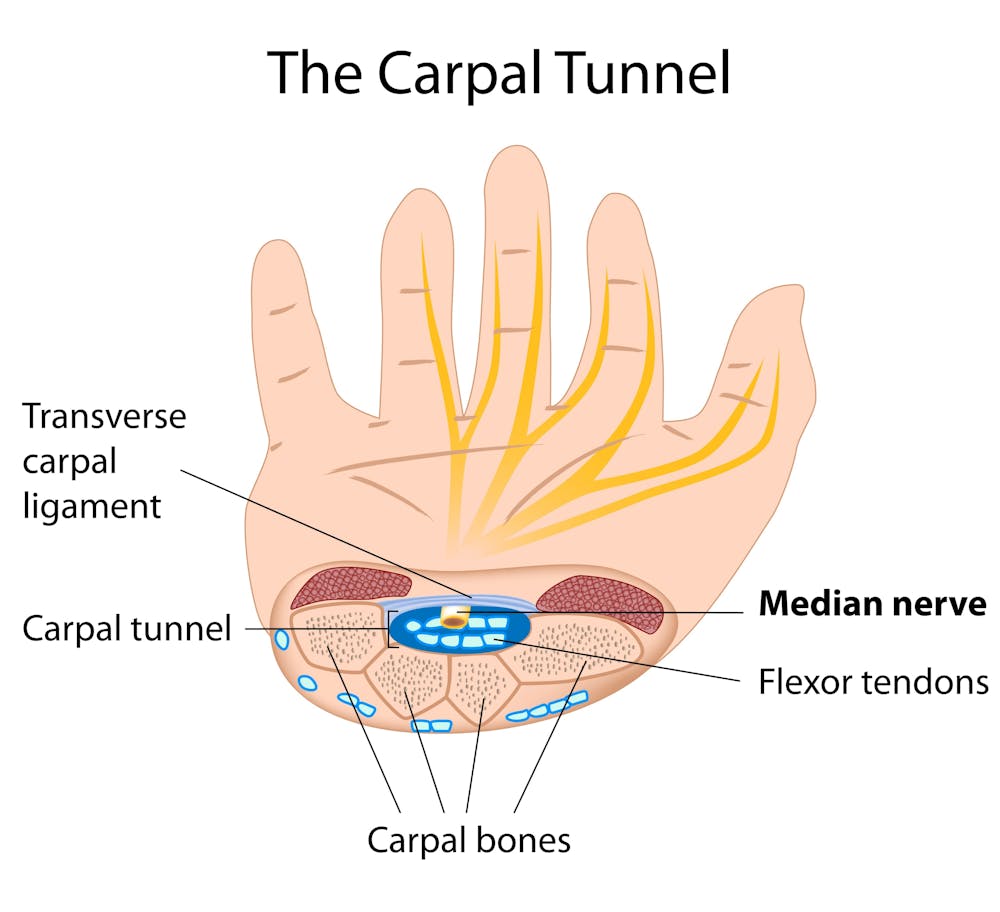 Carpal tunnel