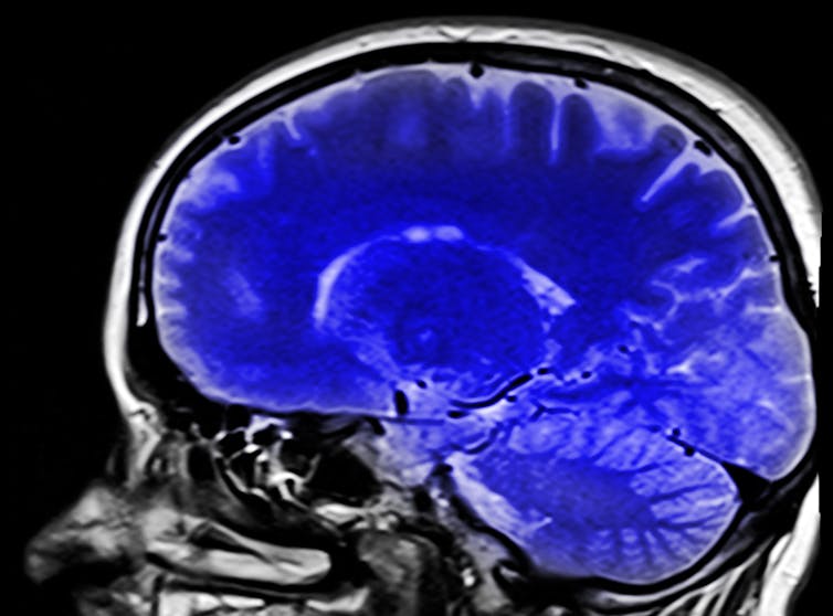Six règles pour régénérer son cerveau