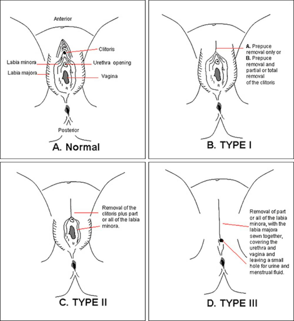 Labia types of Laura Dodsworth: