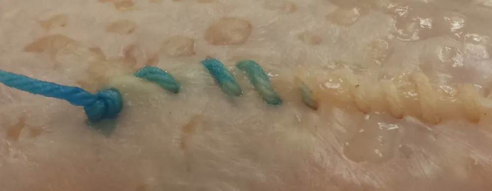 Blood Threads The next frontier in medical sensing: Threads coated in nanomaterials