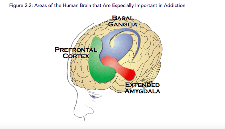 Regions of the brain are affected differently by alcohol. Surgeon General's Report on Addiction