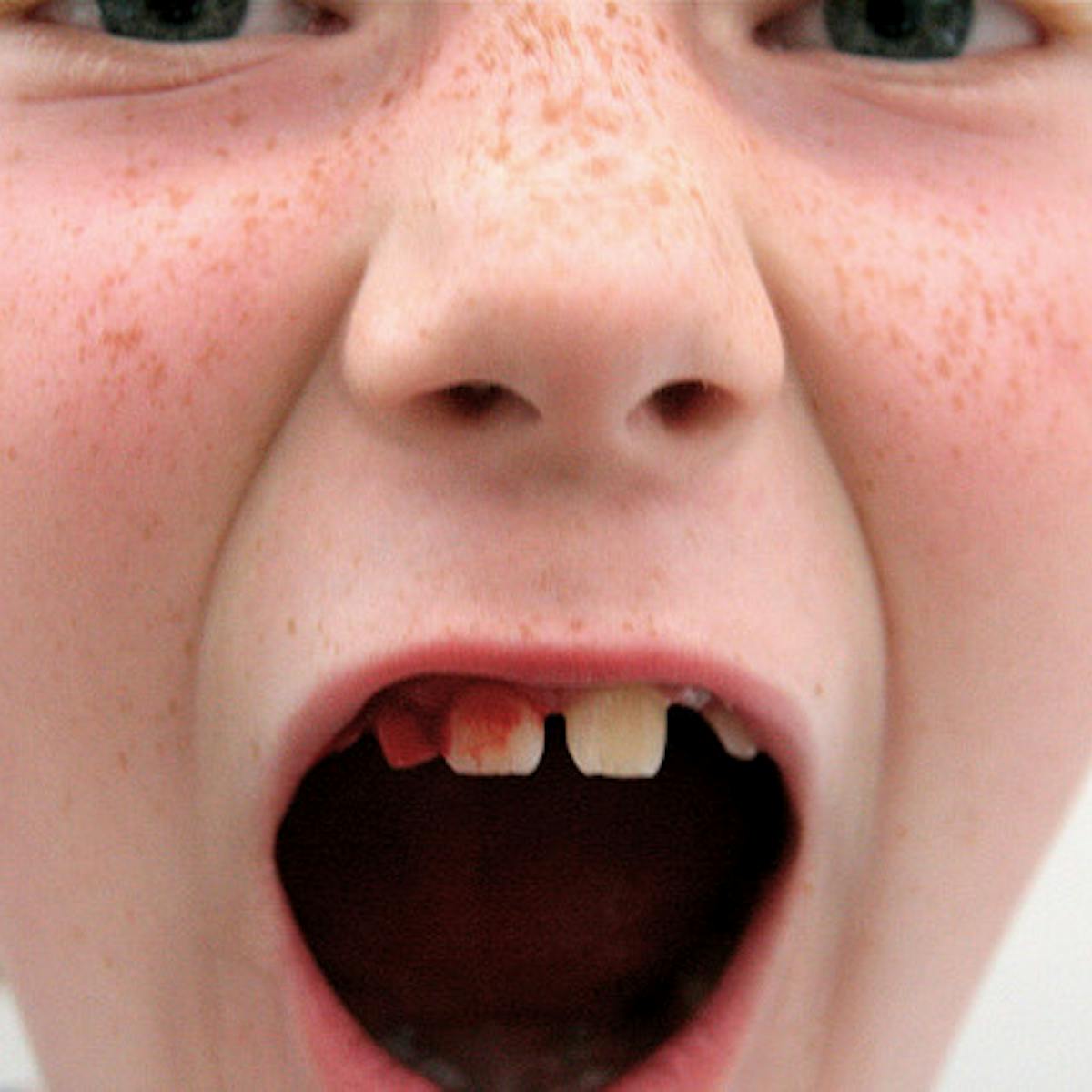 Monday S Medical Myth Knocked Out Teeth Are History Monday S Medical Myth Knocked Out Teeth Are History