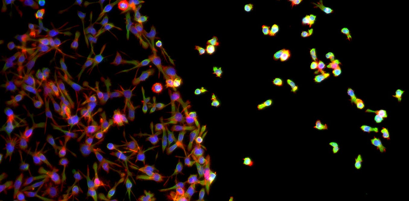 Super microscope shines light on the immune system's front-line defenders