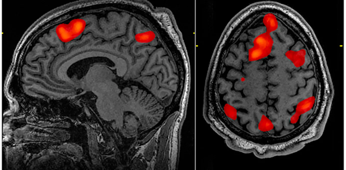 Brainless Scanner Brain scanners allow scientists to ‘read minds’ – could they now enable ...