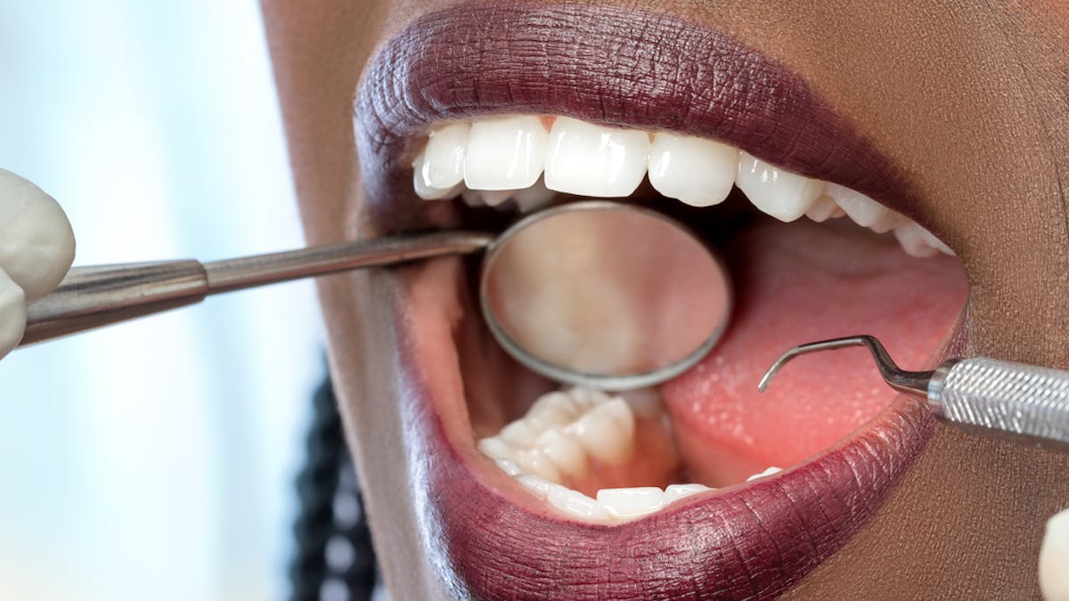 How Gum Disease In Pregnant Women Poses A Risk To Their Newborns How Gum Disease In Pregnant Women Poses A Risk To Their Newborns