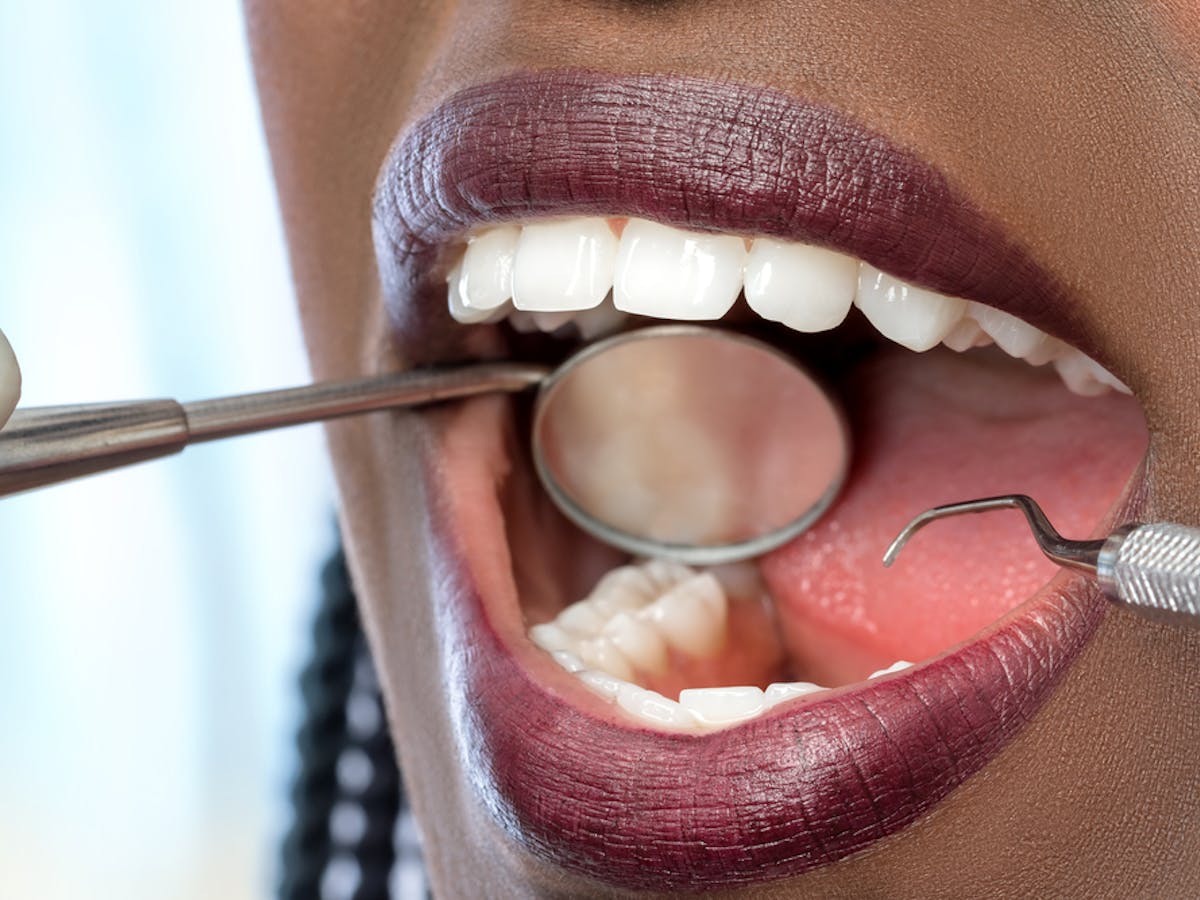 How Gum Disease In Pregnant Women Poses A Risk To Their Newborns How Gum Disease In Pregnant Women Poses A Risk To Their Newborns