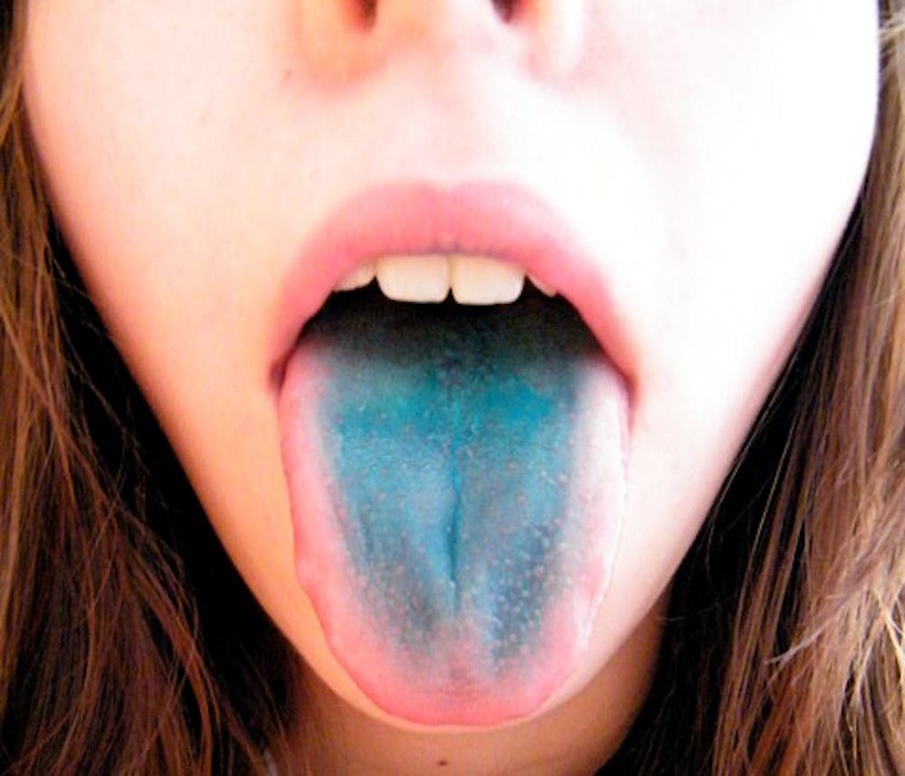 Hate vegetables? You might have super-taster genes! Hate vegetables? You might have super-taster genes!
