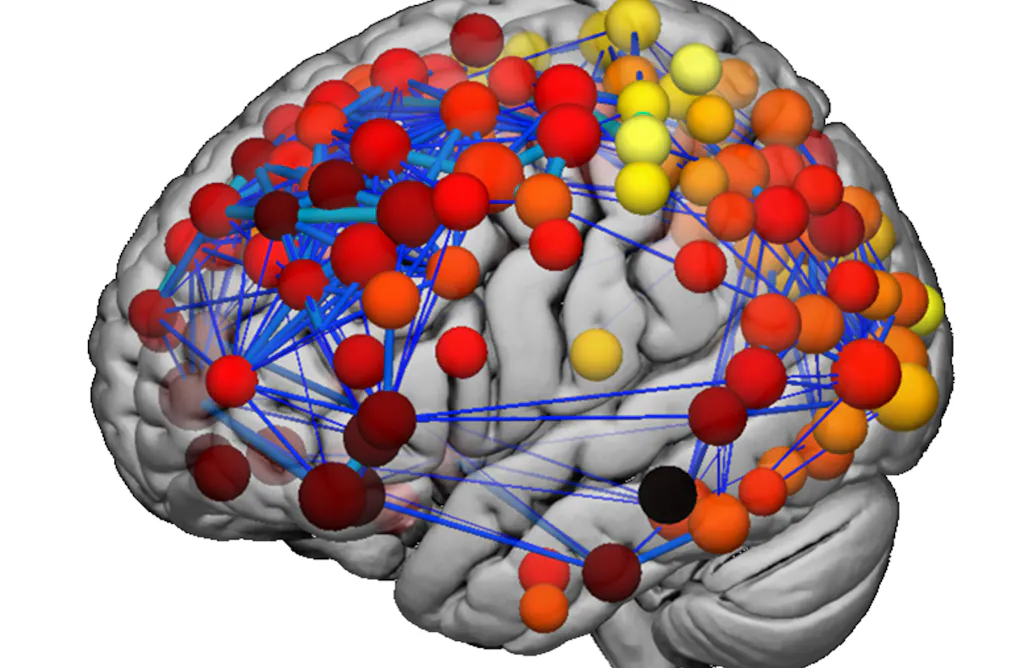 A brain scan to tell if you're depressed – and what treatment is needed