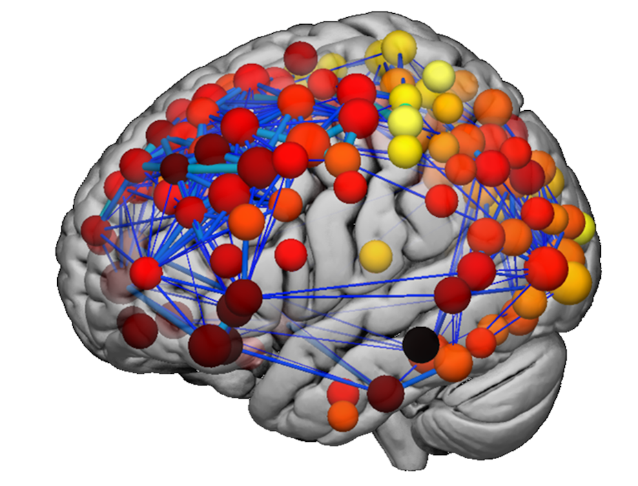 Clues To Autism Schizophrenia Emerge >> How Mapping Teenagers Brains Has Helped Us Understand More About Clues To Autism Schizophrenia Emerge >> How Mapping Teenagers Brains Has Helped Us Understand More About