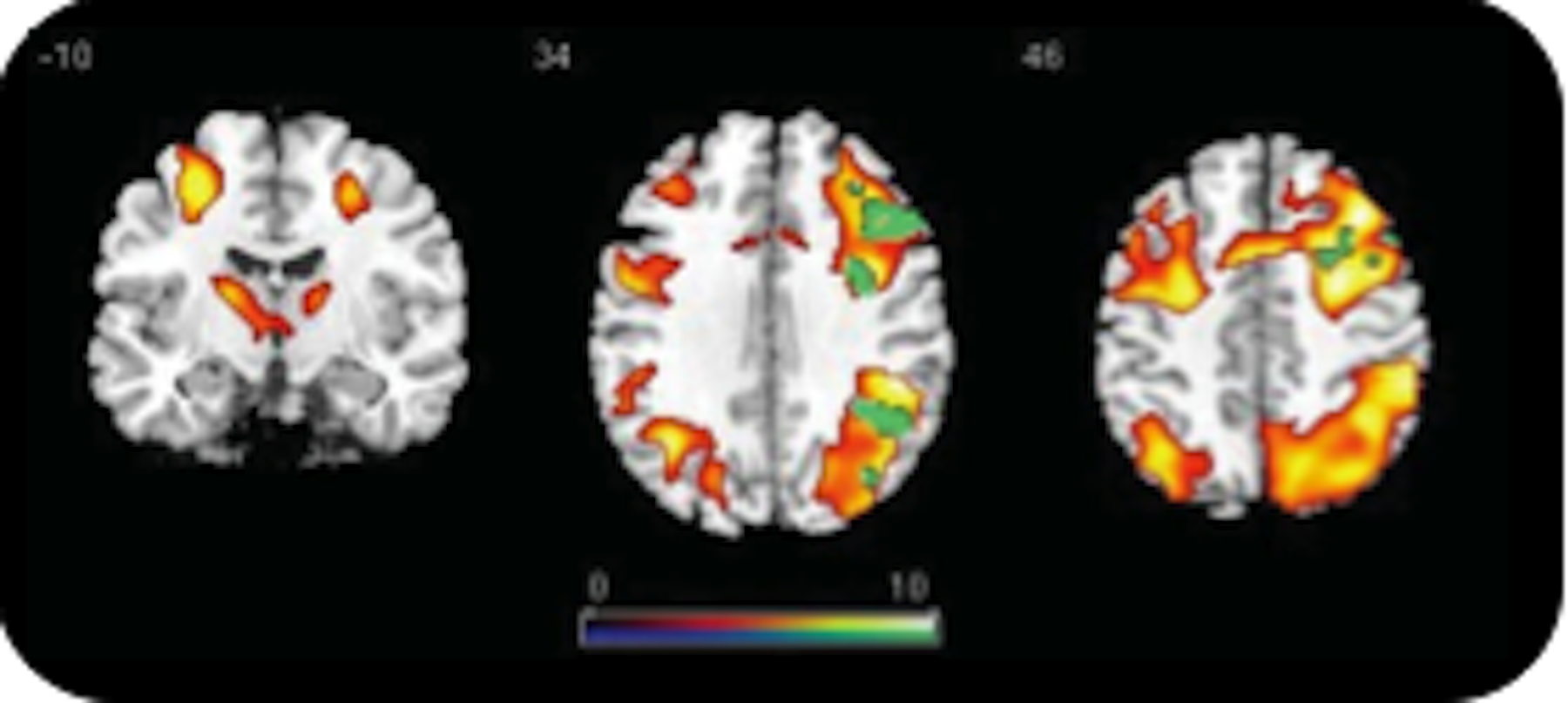 Monday’s medical myth: we only use 10% of our brain