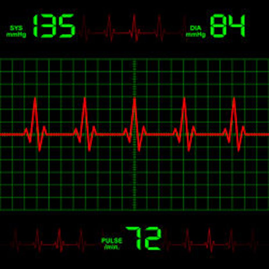 normal heart rate